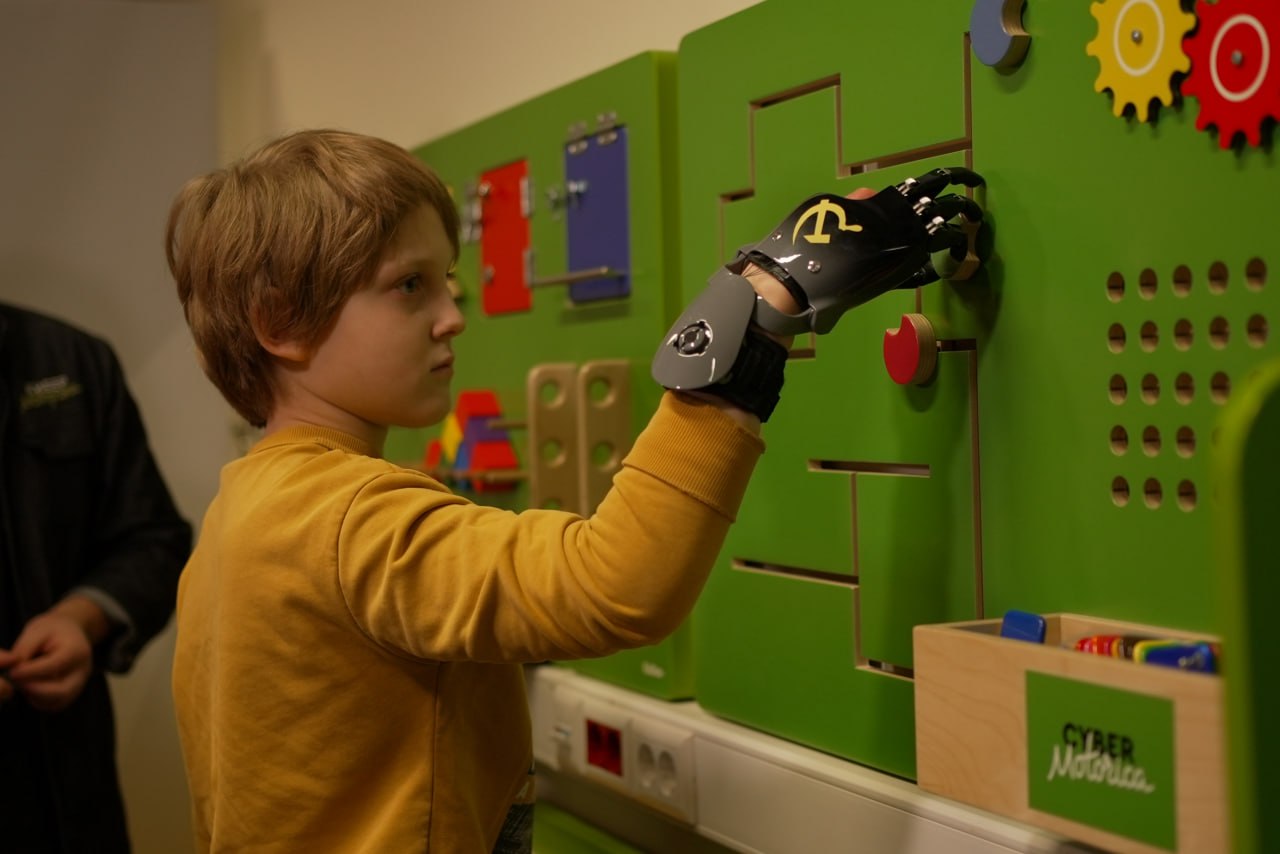 Для Глеба изготовили индивидуальный протез пальцев Для Глеба изготовили индивидуальный протез пальцев