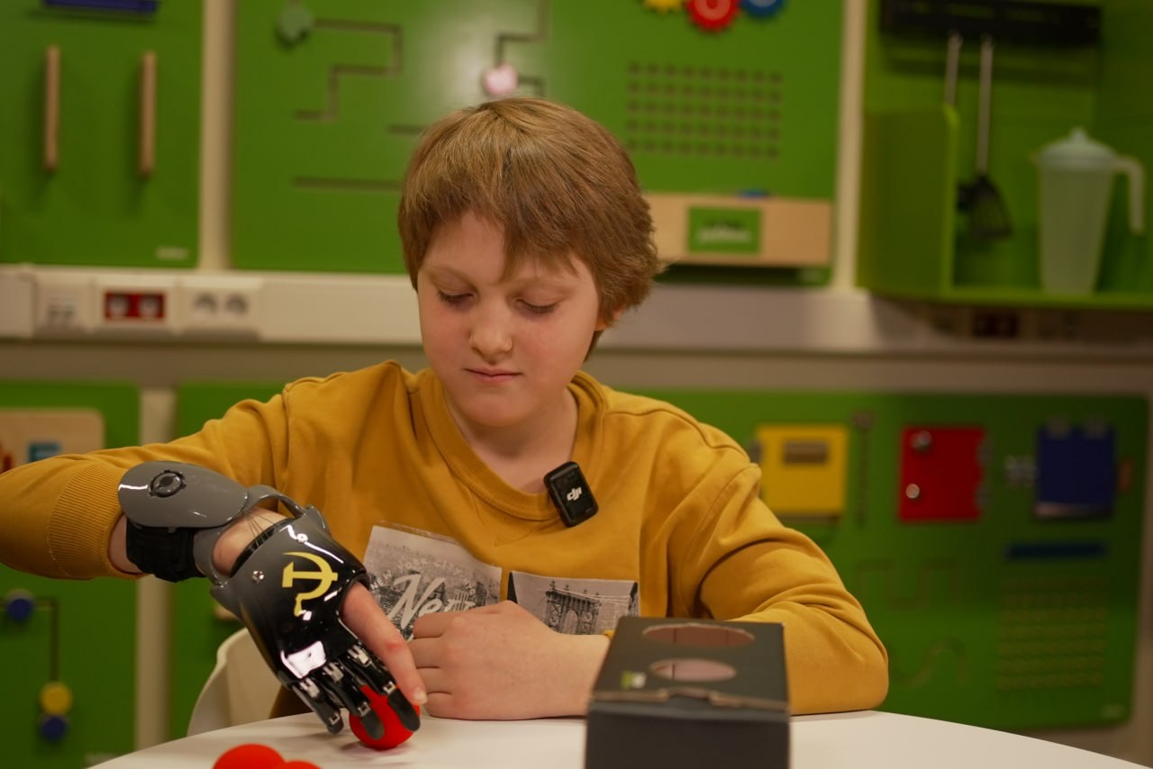 Для Глеба изготовили индивидуальный протез пальцев Для Глеба изготовили индивидуальный протез пальцев