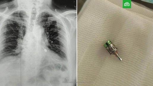 ����� ����� � �������: ����������������� ��� ����� � ������ ������ ������������ ����� �� ����� ������� ����� � ������� �������