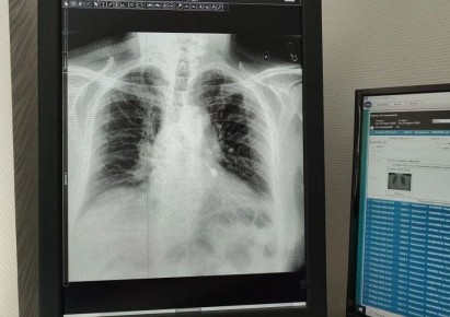 ��������� ������� ����������������� ��� �� ����� ������� �����