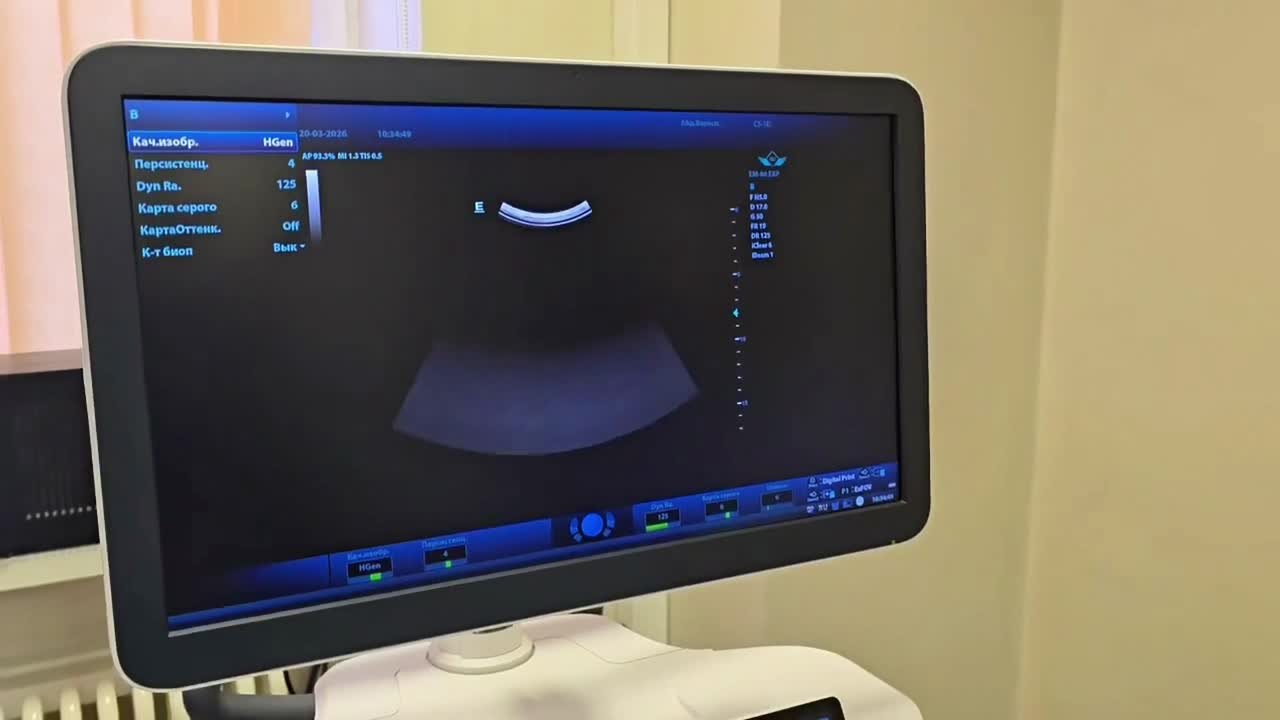 В Коломенскую больницу поступил новый аппарат УЗИ экспертного класса