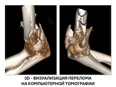 ����� ��������: � ���������� �������� ������� ������� ������� �������� �� �������������� ��������� ������� ����� ������ ������