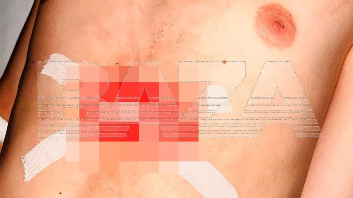 Вооружённый мужчина открыл стрельбу по подросткам в Подмосковье, крича «Крысы е**чие!» Вооружённый мужчина открыл стрельбу по подросткам в Подмосковье, крича «Крысы е**чие!»