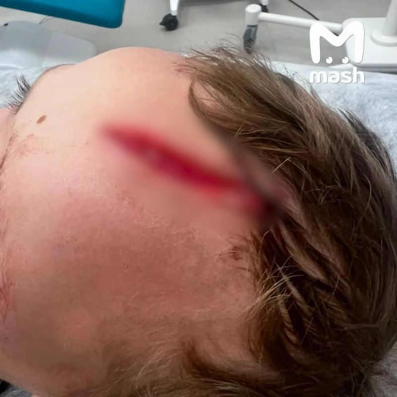 На внука Дарьи Донцовой напала собака у его дома в Подмосковье — огромный пёс набросился на ребёнка и стал кусать его за голову На внука Дарьи Донцовой напала собака у его дома в Подмосковье — огромный пёс набросился на ребёнка и стал кусать его за голову