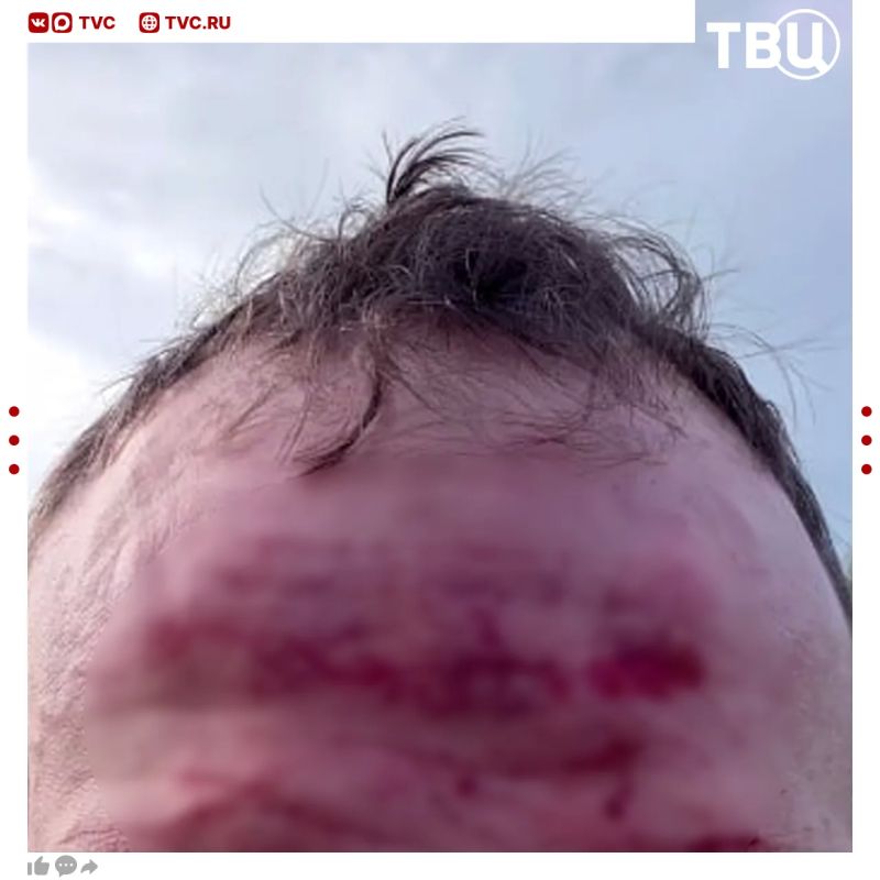 Байкер получил контузию после столкновения с вороной на скорости 270 км/ч в Подмосковье Байкер получил контузию после столкновения с вороной на скорости 270 км/ч в Подмосковье