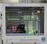 Врачи Воскресенской больницы получили технику для мониторинга жизненных показателей пациентов