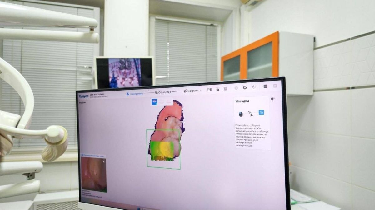 В детской стоматологии Подольска начали делать 3D-модели зубов без слепков В детской стоматологии Подольска начали делать 3D-модели зубов без слепков